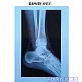 顺为蓝基胶片_医用喷墨打印胶片